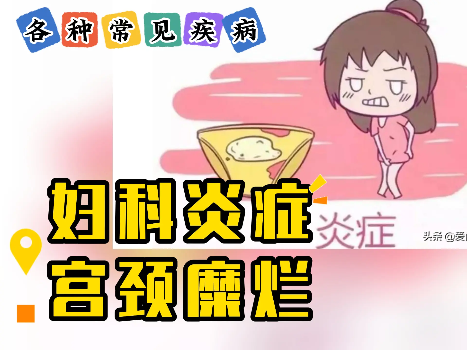 排瘀疗法治疗“妇科炎症、宫颈糜烂”-中医排瘀疗法