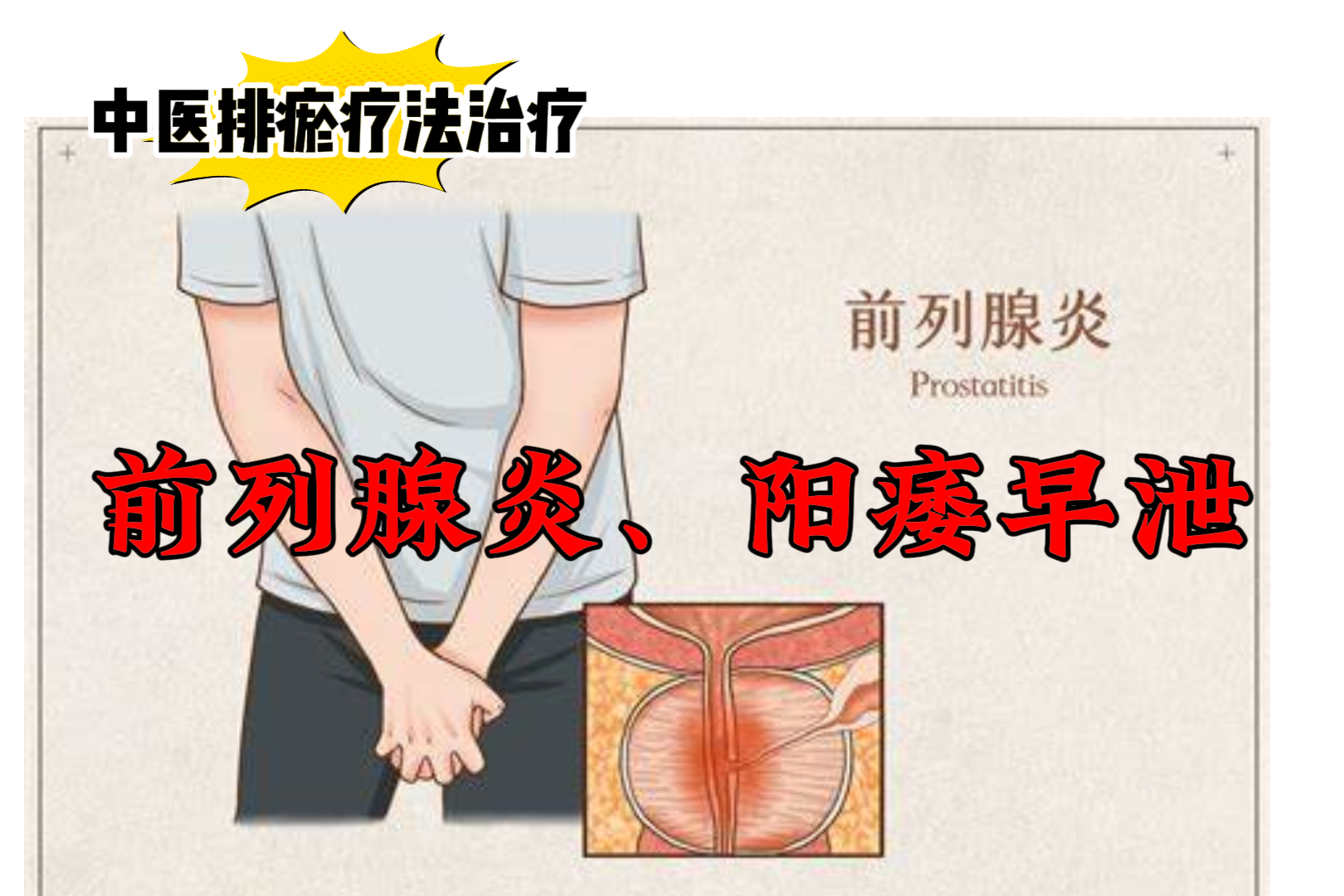 排瘀疗法治疗“前列腺炎、阳痿早泄”-中医排瘀疗法