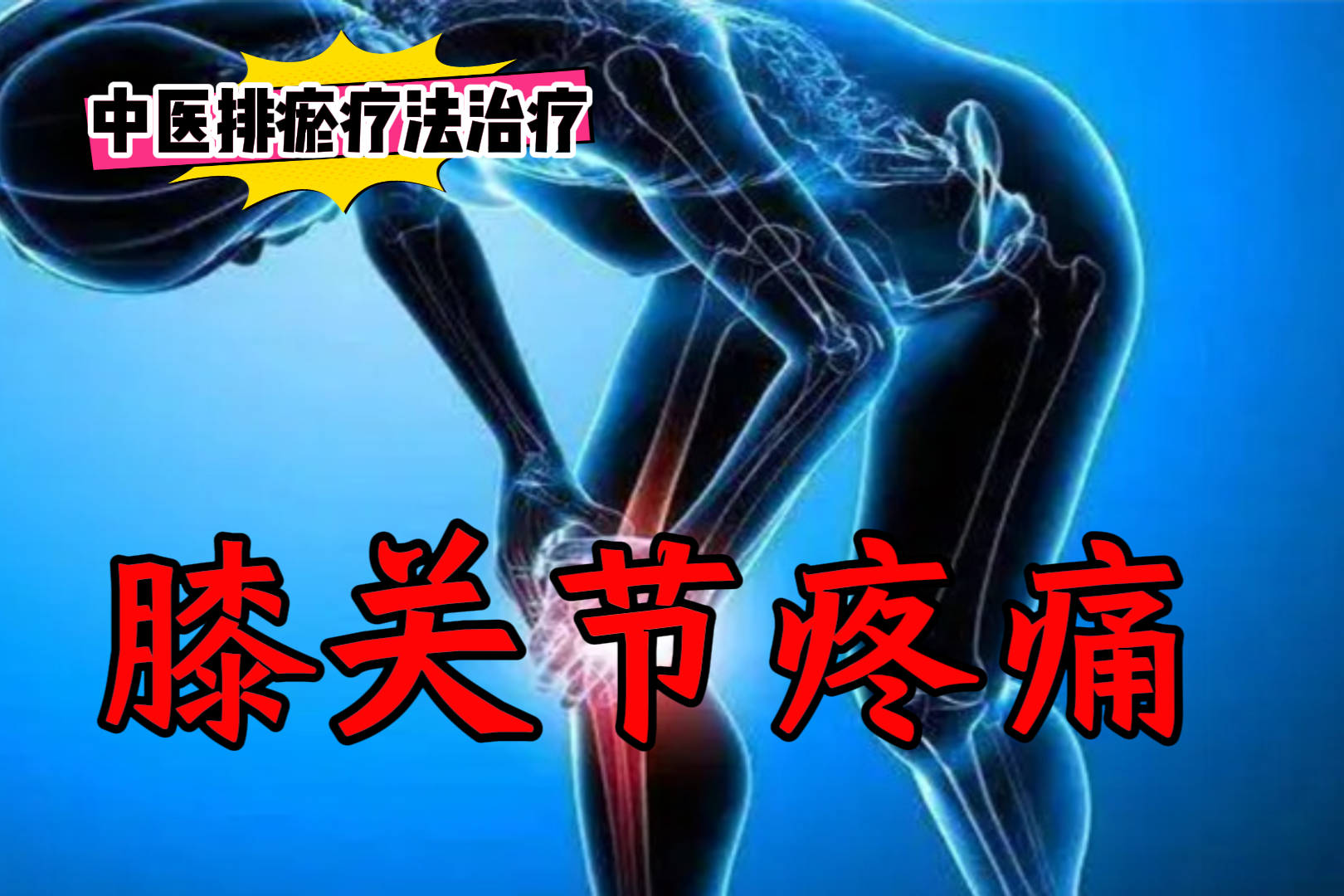 排瘀疗法治疗“膝关节疼痛”-中医排瘀疗法