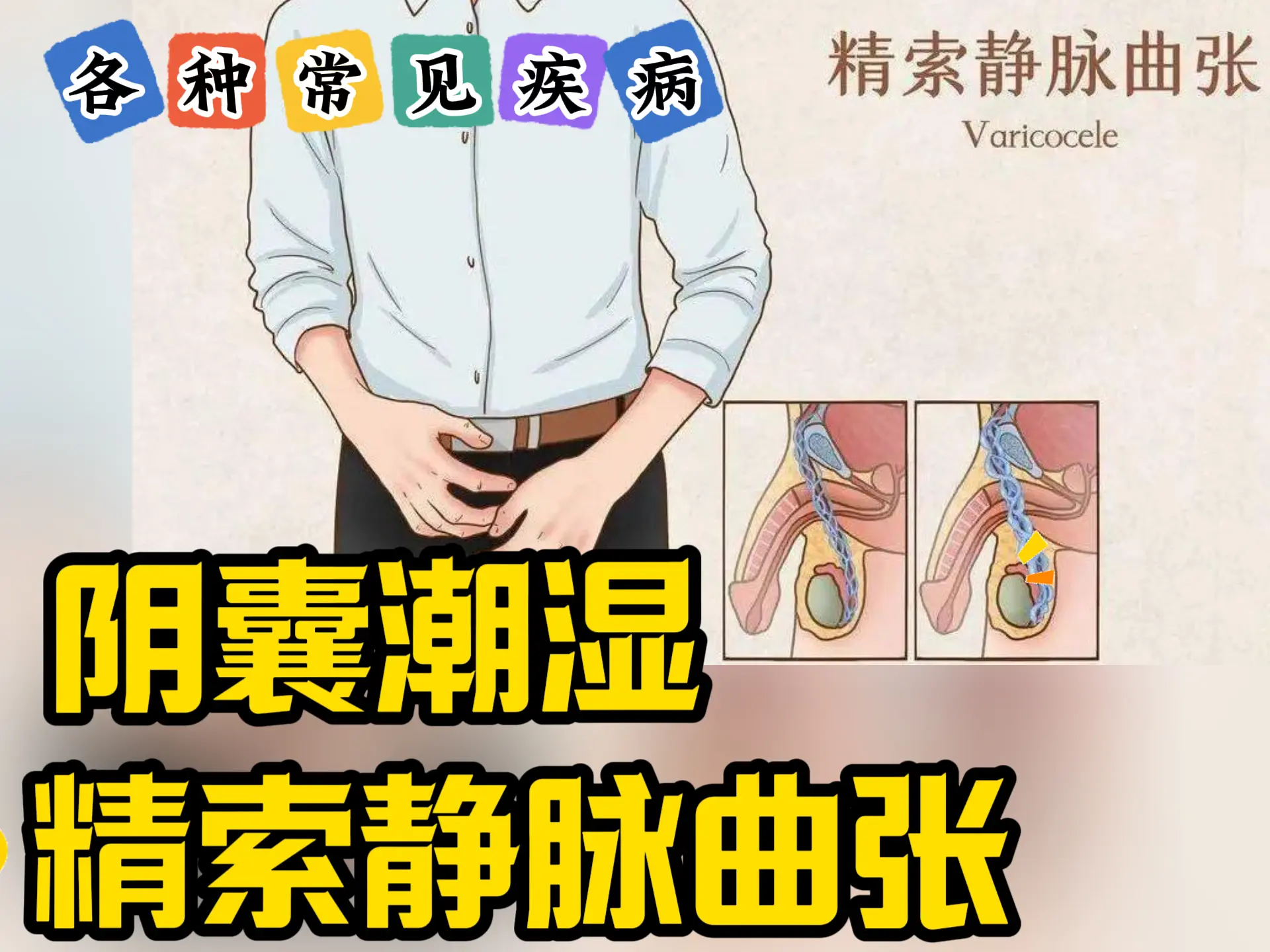 排瘀疗法治疗“阴囊潮湿、精索静脉曲张”-中医排瘀疗法