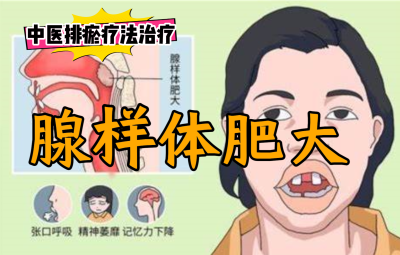 排瘀疗法治疗“腺样体肥大”-中医排瘀疗法