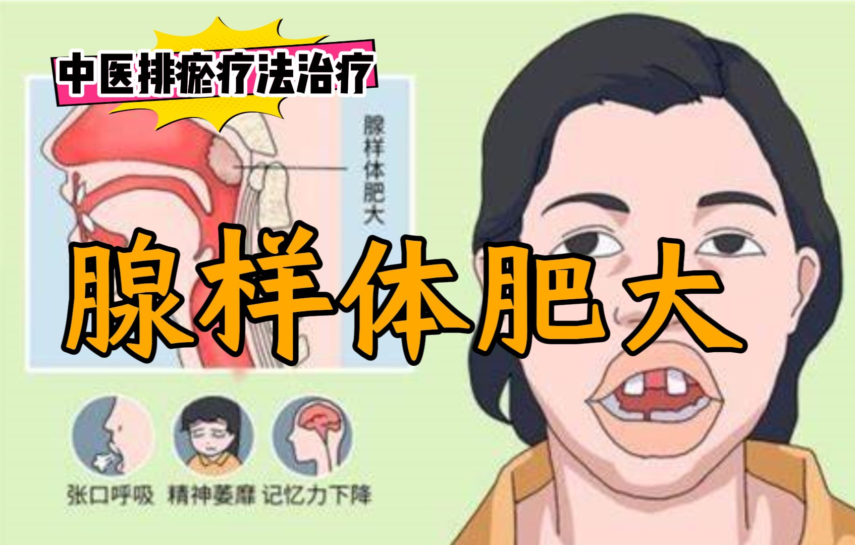 排瘀疗法治疗“腺样体肥大”-中医排瘀疗法
