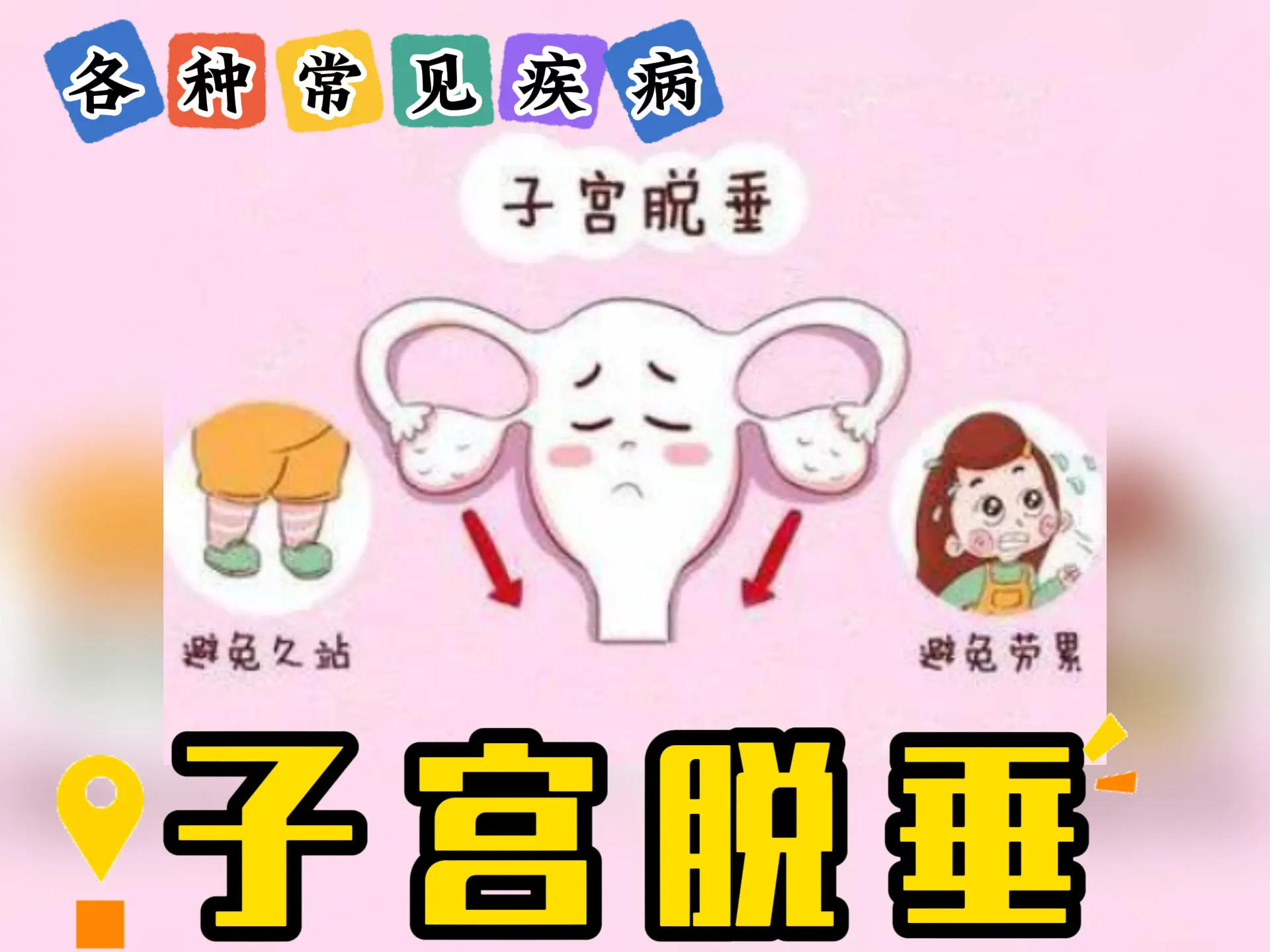 排瘀疗法治疗”子宫脱垂“-中医排瘀疗法
