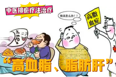 排瘀疗法治疗“高血脂、脂肪肝”-中医排瘀疗法