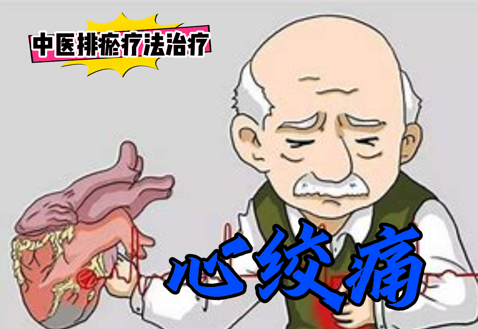 排瘀疗法治疗“心绞痛”-中医排瘀疗法