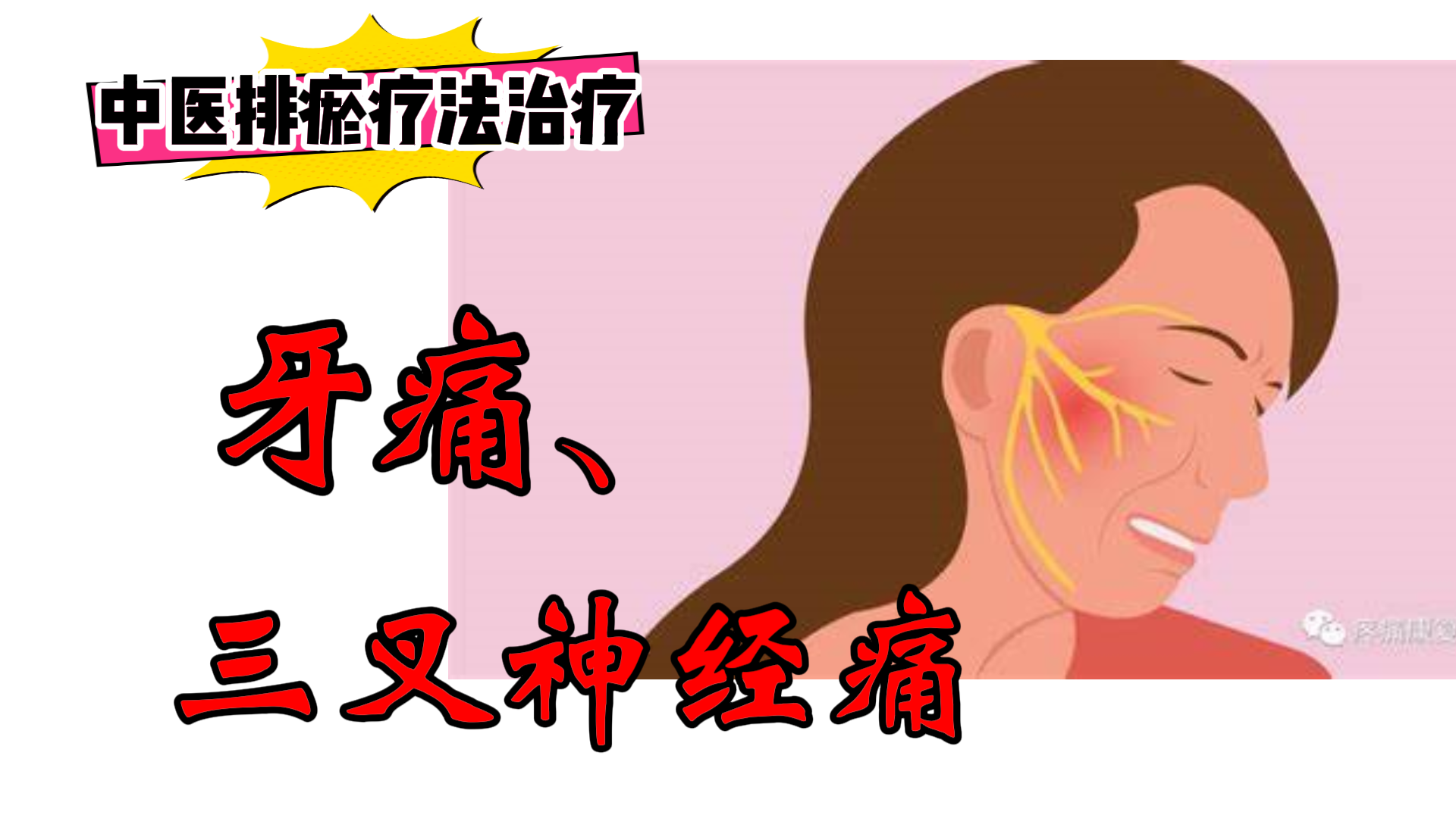 排瘀疗法治疗“牙痛、三叉神经痛”-中医排瘀疗法
