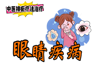 排瘀疗法治疗“眼睛疾病”-中医排瘀疗法
