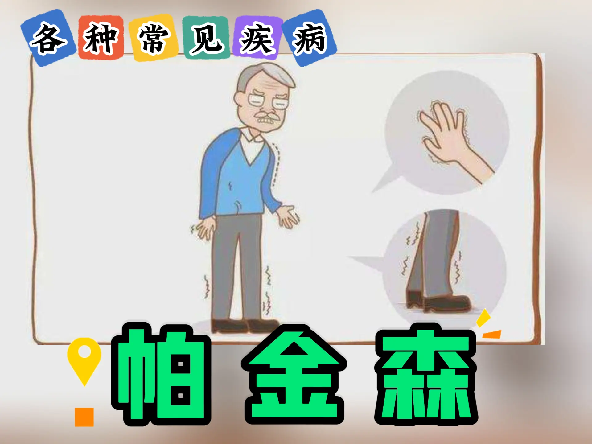 排瘀疗法治疗“帕金森”-中医排瘀疗法