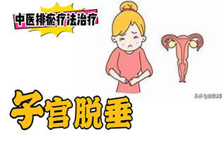 排瘀疗法治疗”子宫脱垂“-中医排瘀疗法