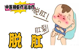排瘀疗法治疗”脱肛“-中医排瘀疗法