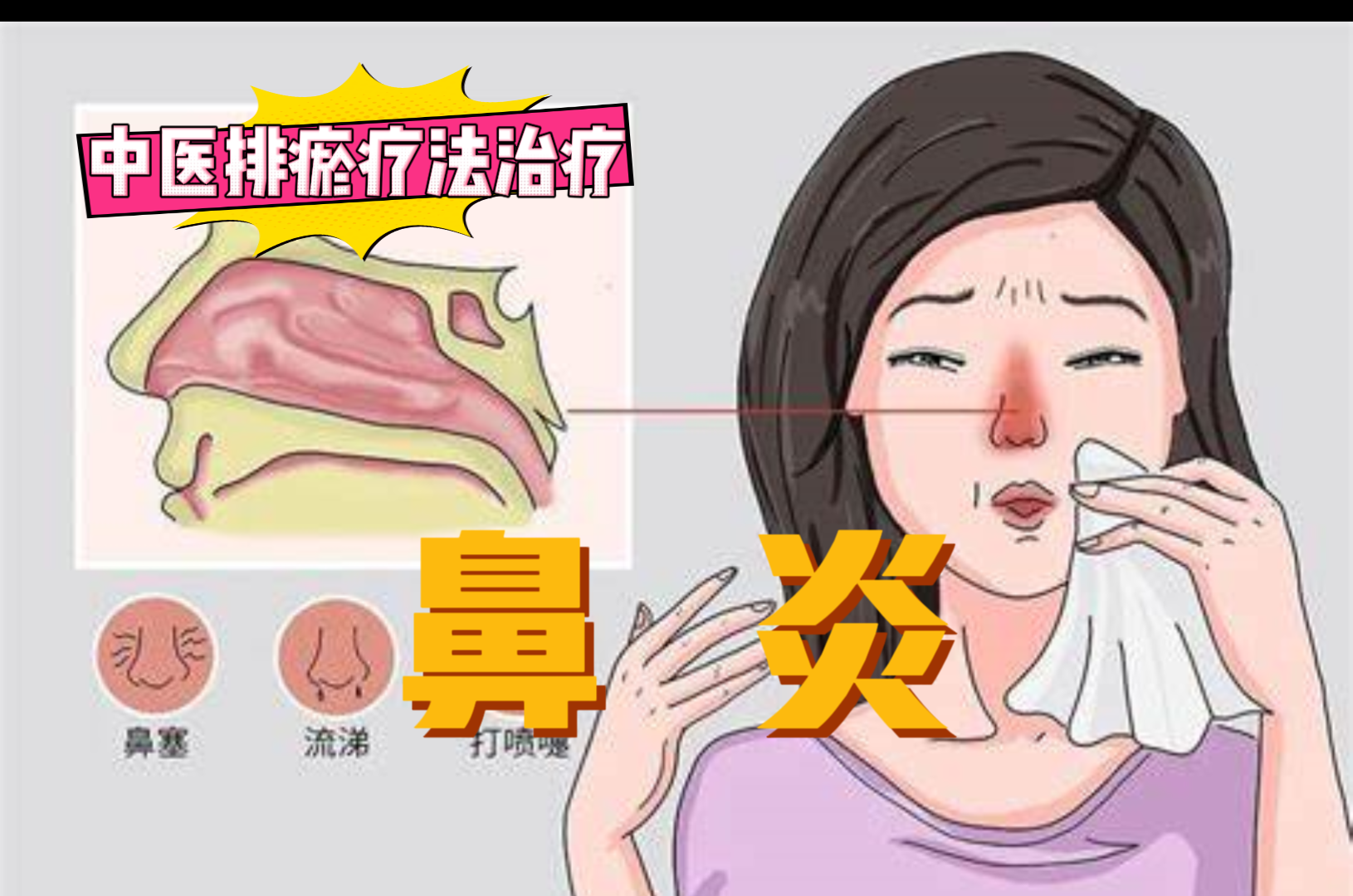 排瘀疗法治疗“鼻炎”-中医排瘀疗法