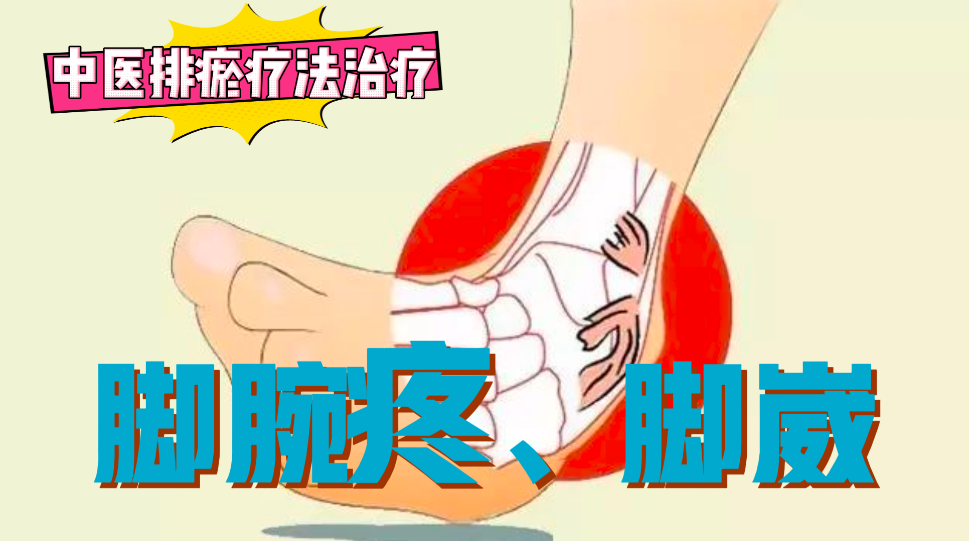 排瘀疗法治疗“脚腕疼、脚崴”-中医排瘀疗法