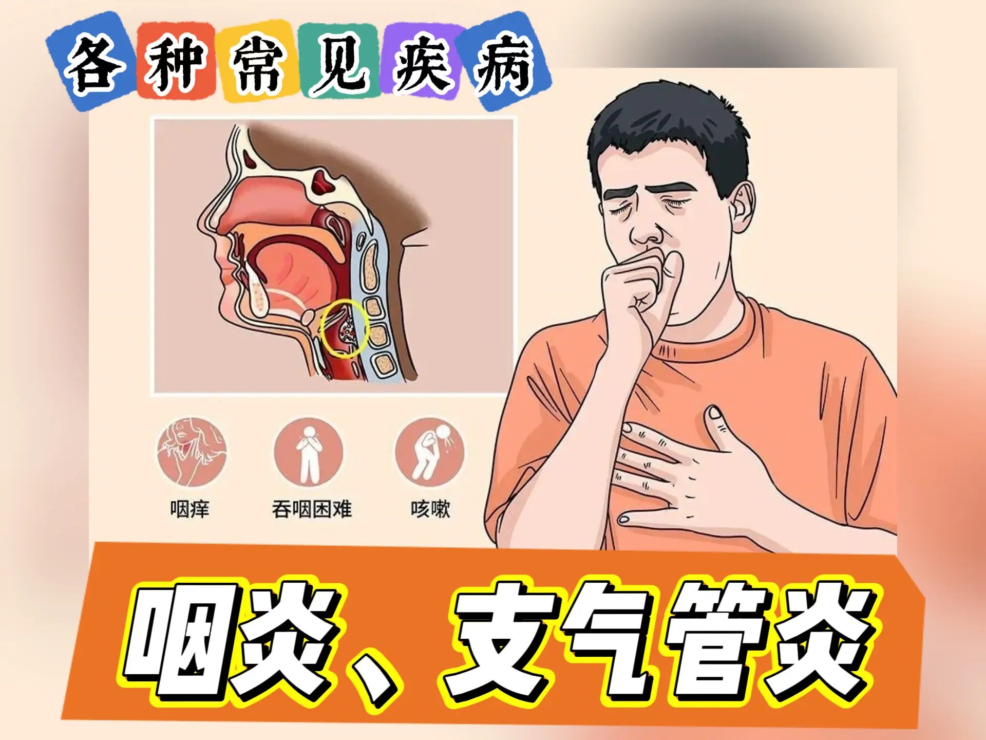 排瘀疗法治疗“咽炎、支气管炎”-中医排瘀疗法