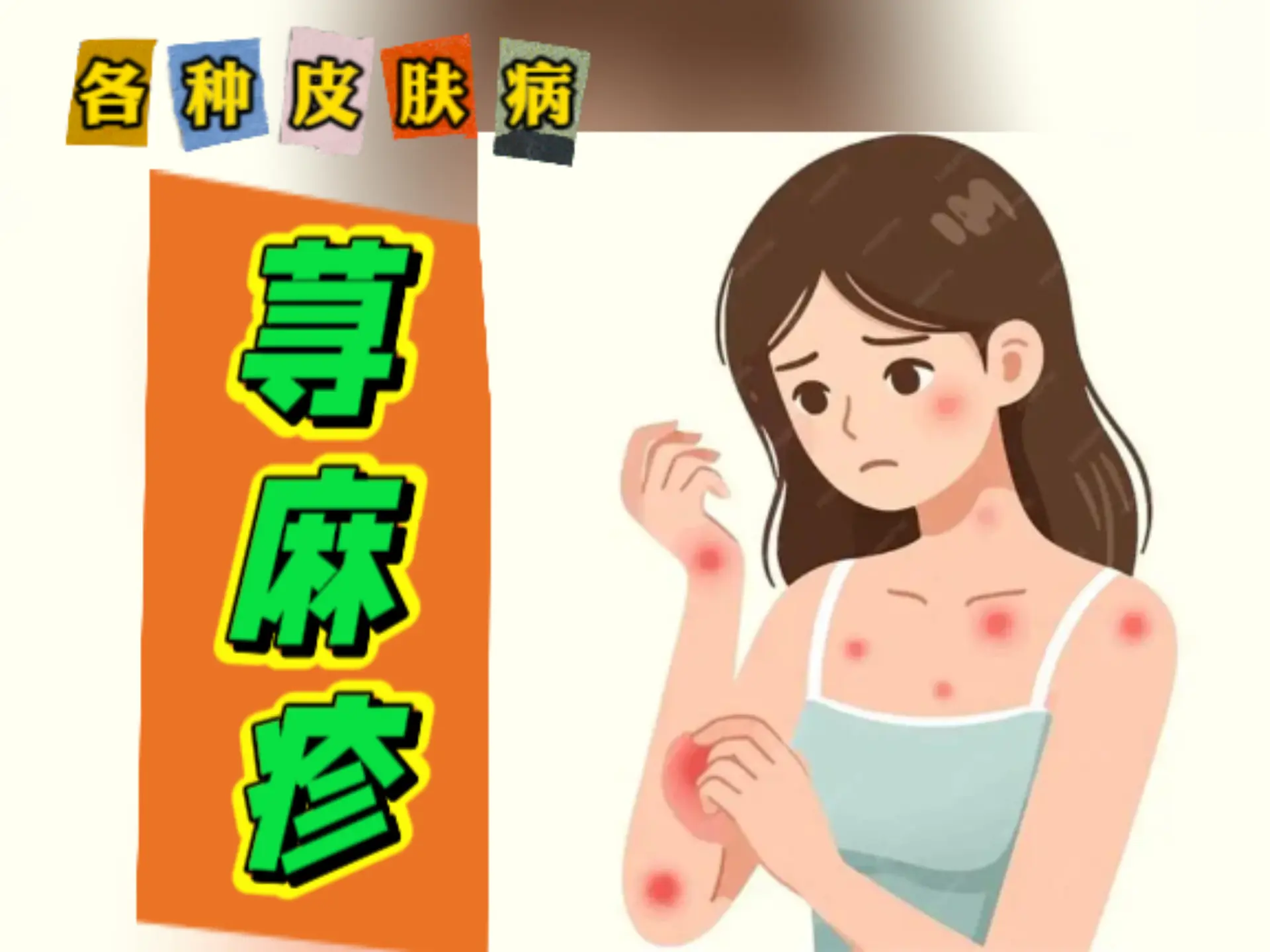 中医排瘀疗法治疗“荨麻疹”-中医排瘀疗法