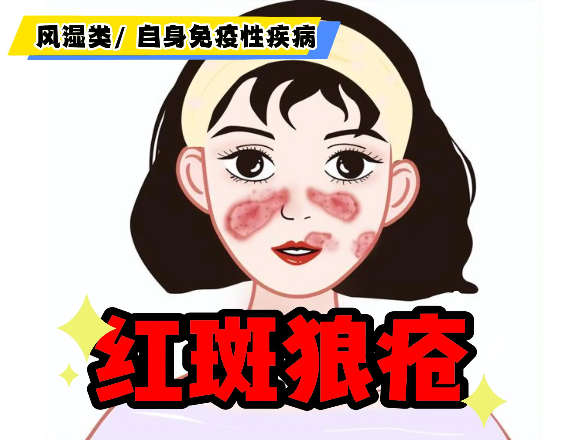 中医排瘀疗法治疗“红斑狼疮”-中医排瘀疗法