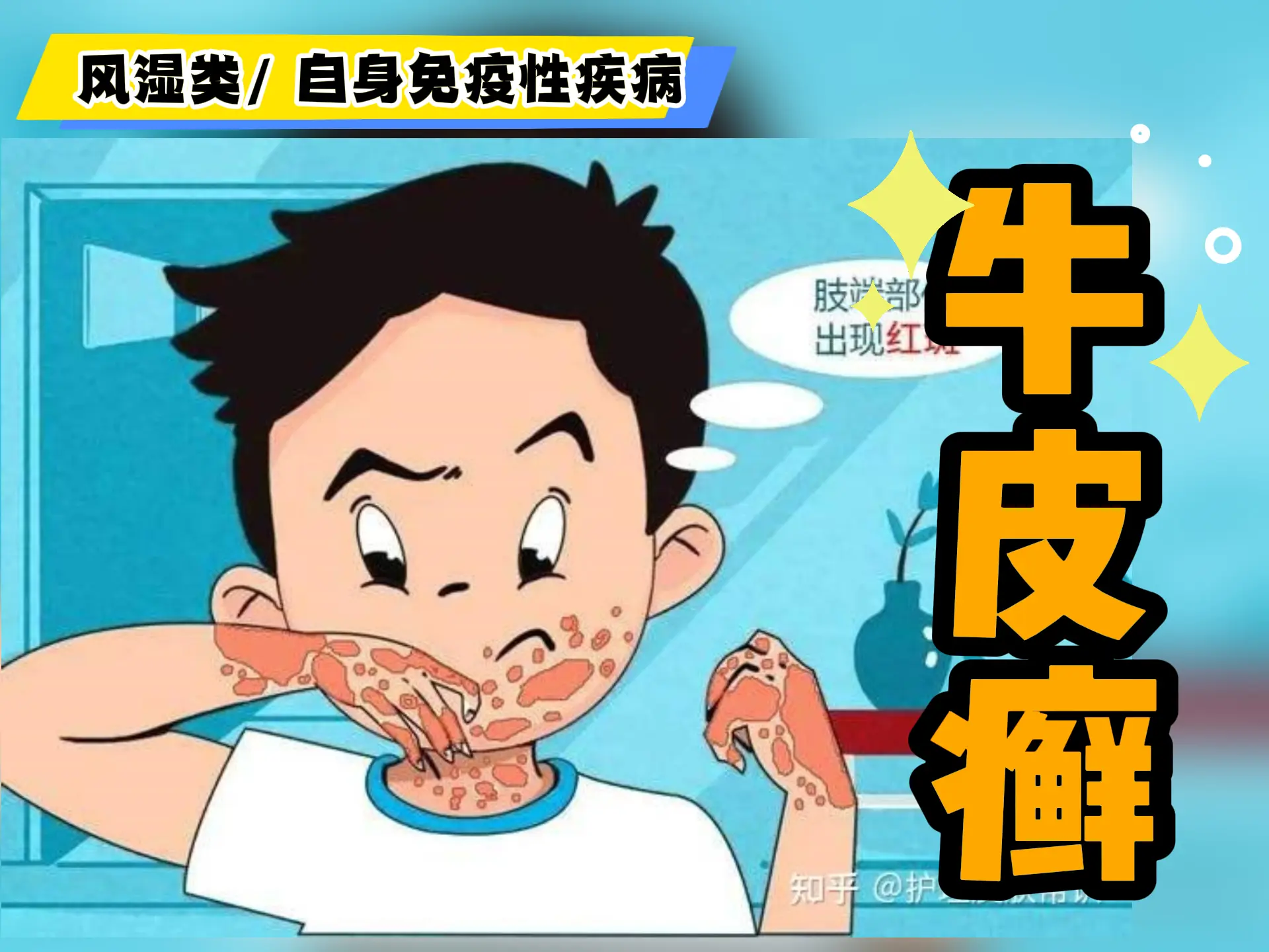 中医排瘀疗法治疗“牛皮癣”-中医排瘀疗法