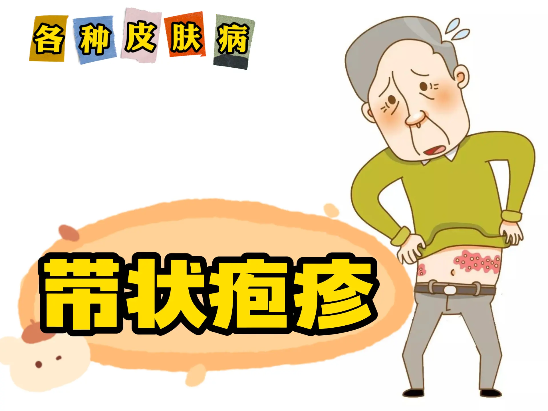 中医排瘀疗法治疗“带状疱疹”-中医排瘀疗法