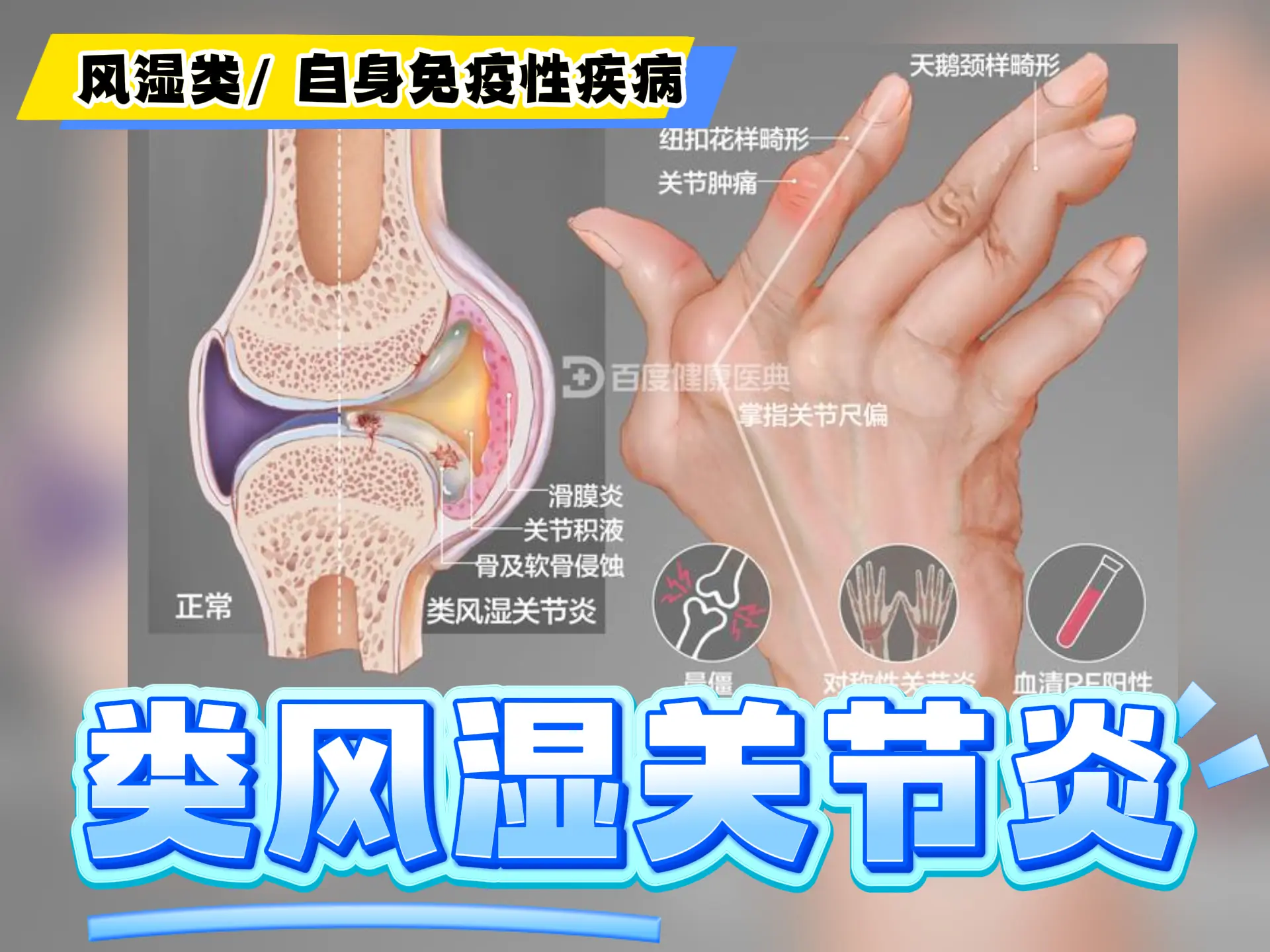 中医排瘀疗法治疗 