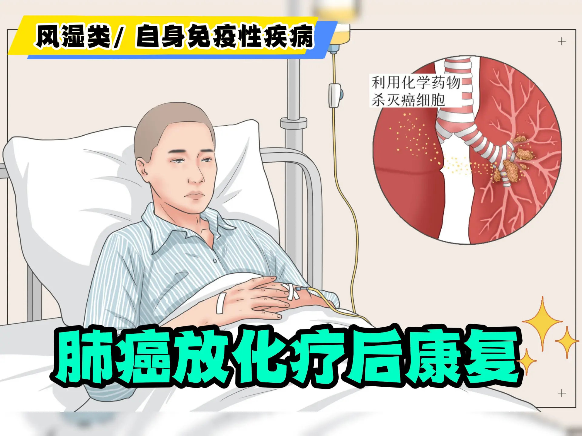 肺癌放化疗后康复排瘀-中医排瘀疗法