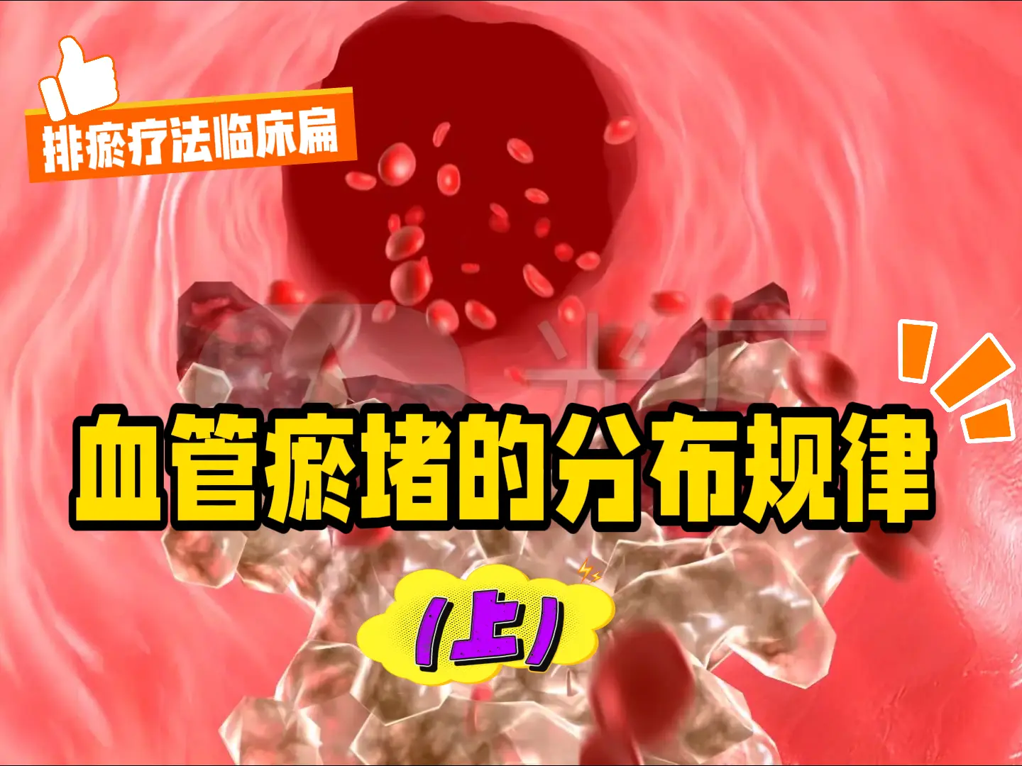 1 血管瘀堵的分布规律（上）-中医排瘀疗法