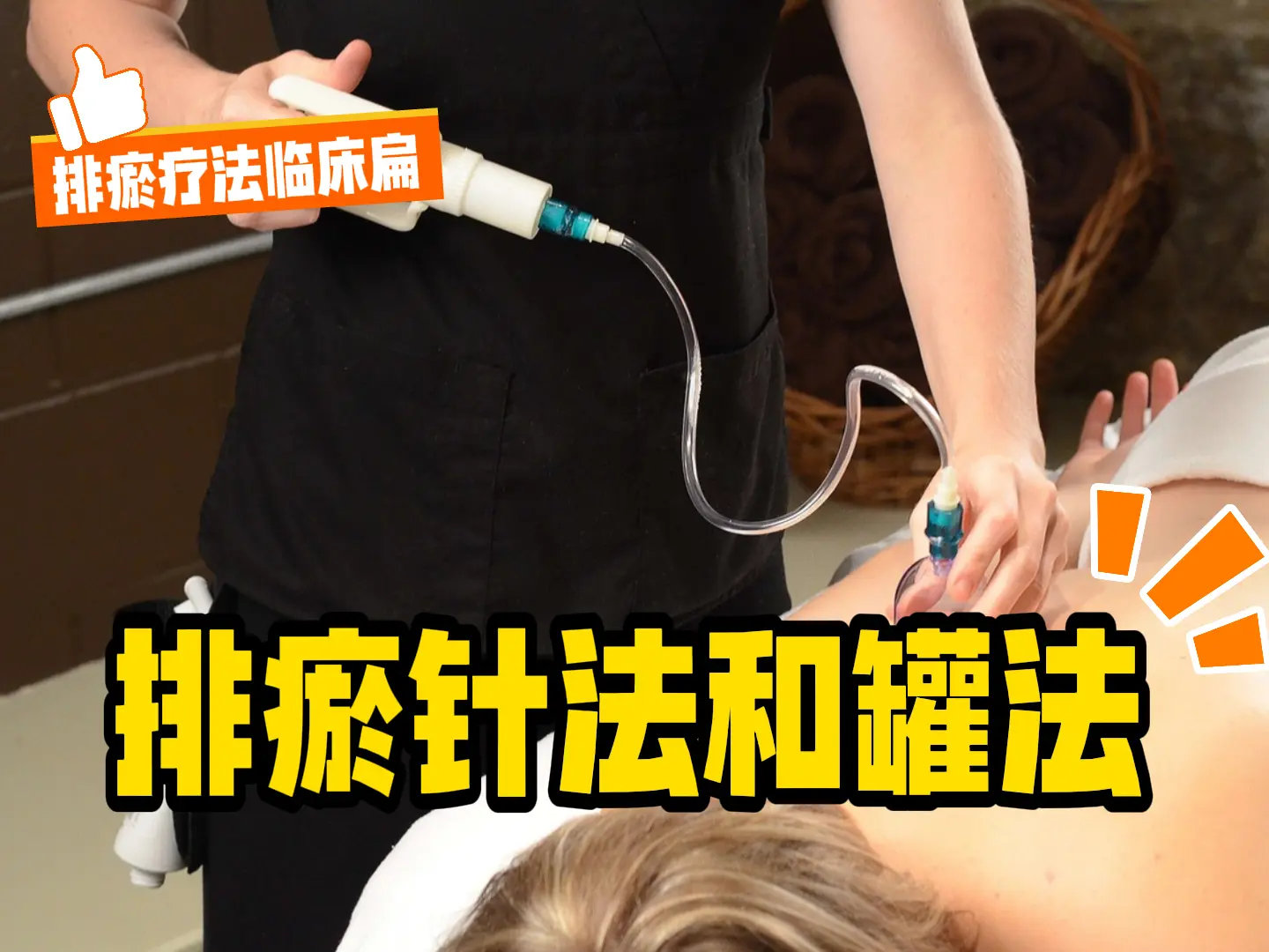 16 排瘀针法和罐法-中医排瘀疗法
