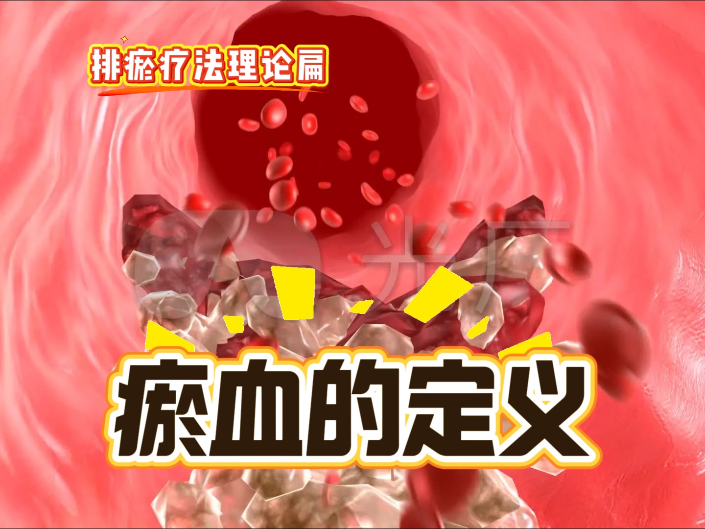 2 瘀血的定义-中医排瘀疗法