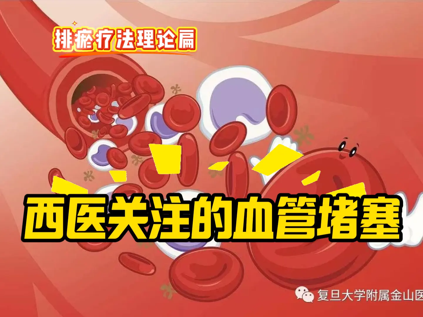 3 西医关注的血管堵塞-中医排瘀疗法