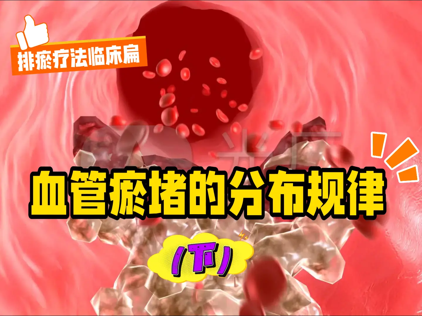 3 血管瘀堵的分布规律（下）-中医排瘀疗法