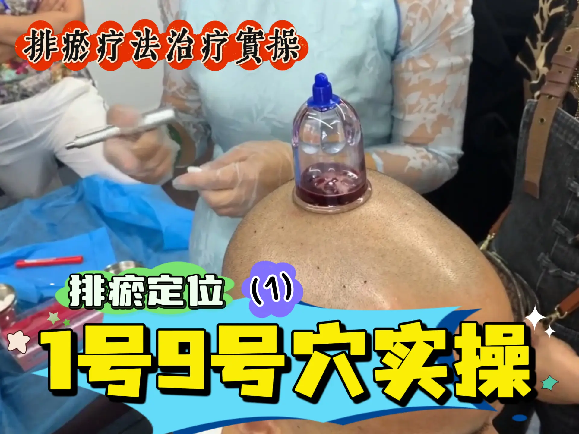 排瘀定位1、9号穴实操-中医排瘀疗法