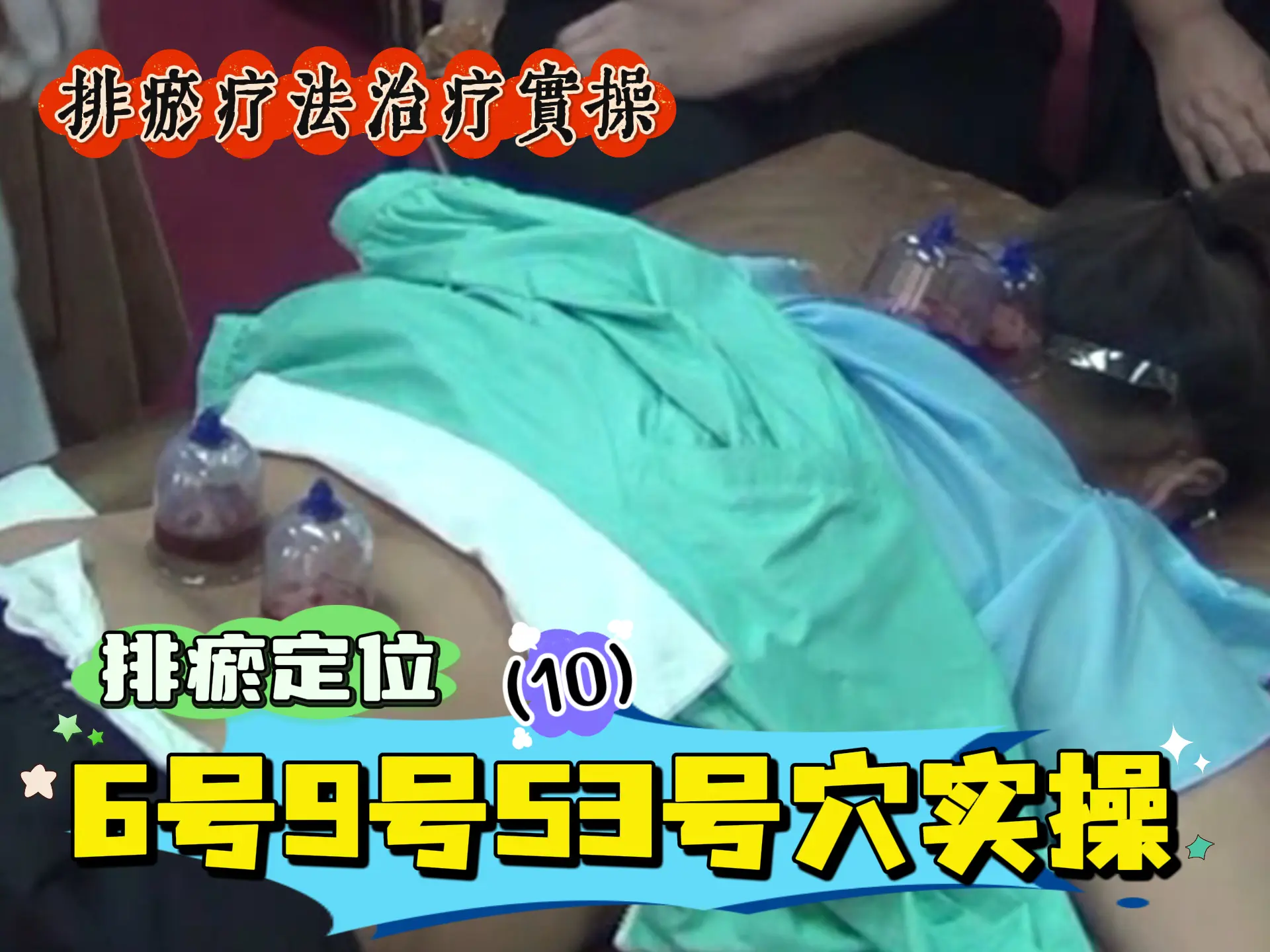 排瘀定位（10）6号9号53号穴实操-中医排瘀疗法