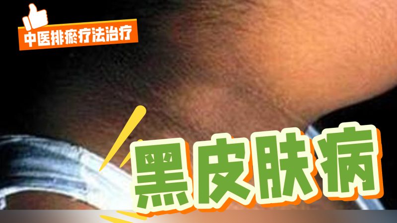 中医排瘀疗法治疗“黑皮肤病”-中医排瘀疗法