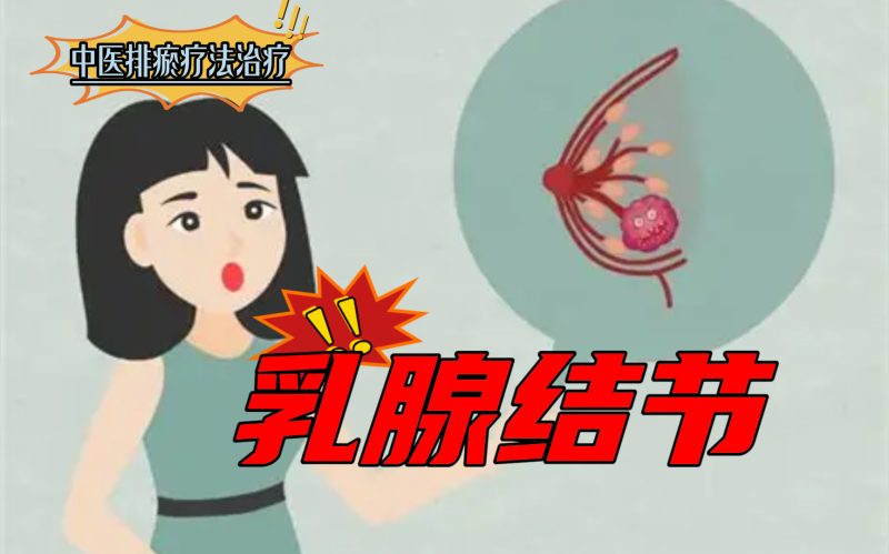 排瘀疗法治疗“乳腺结节”-中医排瘀疗法