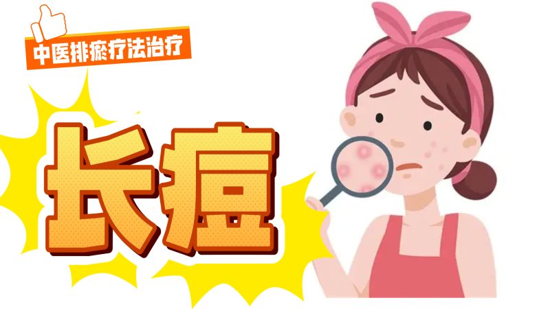 中医排瘀疗法治疗“长痘”-中医排瘀疗法